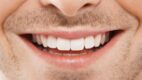 Blisko 3,5 mln zł kary dla Dr Smile za działania naruszające zbiorowe interesy konsumentów